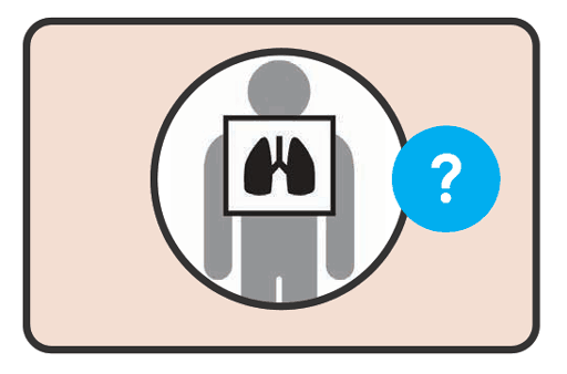 Chest X-ray