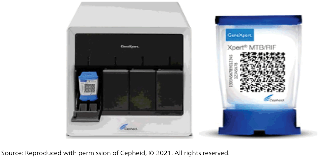 Xpert MTB/RIF and Xpert MTB/RIF Ultra assays | TB Knowledge Sharing